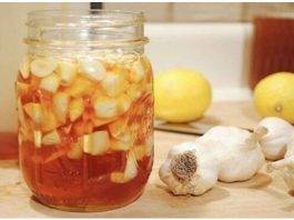 Сосудистый хирург: от варикоза поможет мед с чесноком и старинный русский рецепт