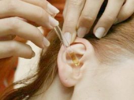 Серные пробки в ушах удалить совсем несложно. Этот рецепт самый безопасный