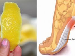 Лимонная цедра — мощнейшее средство от боли в суставах. Проверено на себе