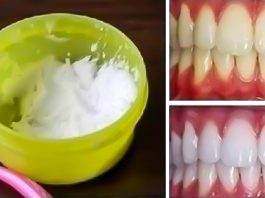 Как отбелить зубы в домашних условиях за 3 минуты: 100%-й результат