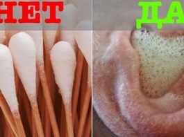 Бойтесь ватных палочек: про ушную серу и как перекисью чистить уши