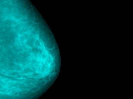 4 симптома рака груди, которые не имеют ничего общего с уплотнениями. Ранние «звоночки» страшной болезни