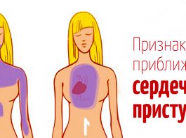 До сердечного приступа, ваше тело будет вам «сигнализировать» — Вот 5 признаков