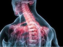 Мышечные зажимы шеи и спины: быстрое снятие боли изменением позы