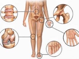 Против боли в суставах: 5 натуральных противовоспалительных средств