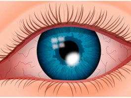 Доказано: это самое мощное средство для восстановления зрения, защиты глаз от старения, катаракты и глаукомы