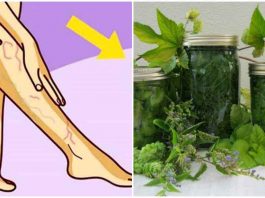 10 рецептов лечения варикоза и тромбофлебита травами, что растут под ногами