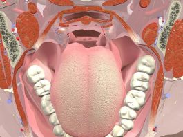 6 проблем в полости рта, за которыми скрываются опасные заболевания