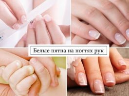 Белые пятна на ногтях рук как следствие нарушений в организме