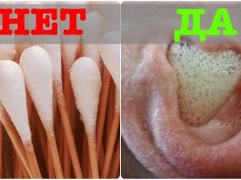 Бойтесь ватных палочек: ушная сера и почему лучше чистить уши перекисью