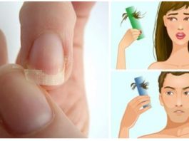 Если у вас тонкие ломкие ногти, выпадение волос или бессонница, начните потреблять это