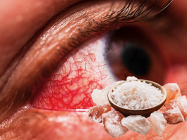 Глазная инфекция и очищение соленой водой: как сделать солевой раствор и помочь глазам