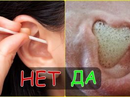 Почему стоит опасаться ватных палочек: ушная сера и как перекисью чистить уши