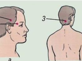 Проверенный способ лечения головной боли