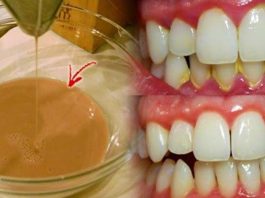 Мощная домашняя жидкость для полоскания рта: устраняет бактериальный налет и отбеливает зубы