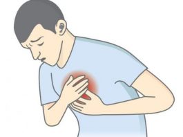 За несколько недель до сердечного приступа тело обычно подает эти 6 сигналов. Не игнорируйте их