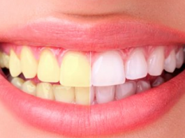 Белые и здοрοвые зубы: 8 хитрοстей дают 100% результат