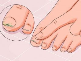 7 нарoдныx срeдств лечения грибка ногтей