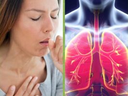 Как начинается пневмония: 6 опасных признаков