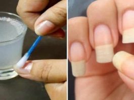 Как легко и быстро отрастить ногти, которые никогда не сломаются: поможет простое средство из 4 компонентов