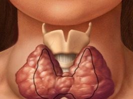 Щитовидная железа — это та, которая контролирует все тело. Вот как сохранить ее здоровье