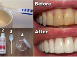 Как избавиться от зубного налета и отбеливать зубы без дорогостоящих процедур. Вам понравится это средство
